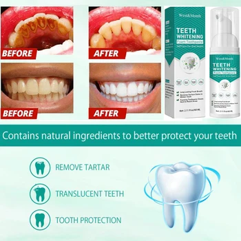 60ml Bielenie Zubov Pena zubná pasta Silný Zubov Bez Citlivosť Bezpečné A Účinné Na Ústne Heath Pôvodný Vzorec