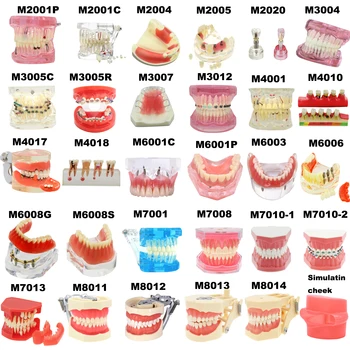 Zubné Zuby Model Zubné Vyučovacie Modely Implantát Model Vymeniteľné Stomatológia Model Zubov Pre Vzdelávanie Štúdium Pacienta Vzdelávania